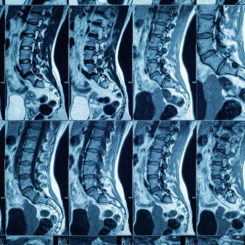 Spine Diagnostics at Stavya